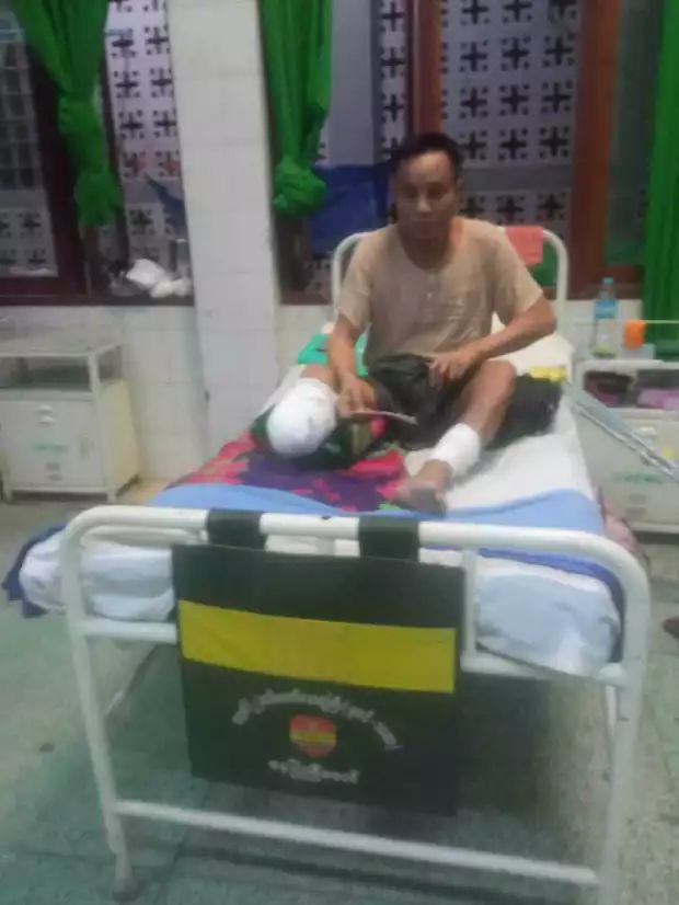 两个月内已有200多名缅军士兵在内比都军医院接受截肢